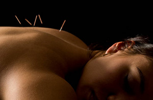 Acupuncture for Pain Relief Huddersfield