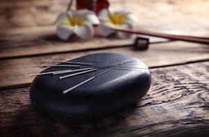 Acupuncture Near Me Daventry