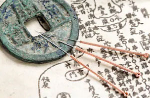 Acupuncture Near Me Rochester Kent Acupuncture Near Me Rochester