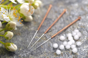 Acupuncture Needles Bishopstoke - Acupuncture Points