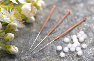 Acupuncture Needles Whitehill - Acupuncture Points