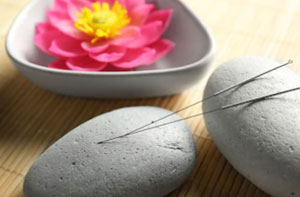 Acupuncture Near Me Woodley