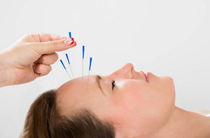 Acupuncture Haslingden