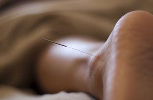 The Credibility of Acupuncture