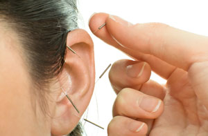 The Credibility of Acupuncture