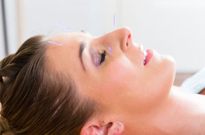 Acupuncturists in Cromer (01263) Acupuncturists in Cromer (01263)
