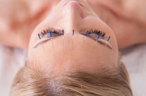 Acupuncturists in Wells (01749)