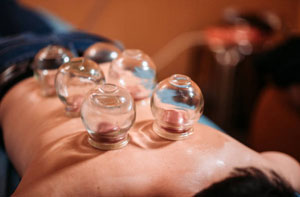 Cupping Therapy Netherfield