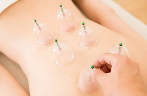 Cupping Therapy Bangor