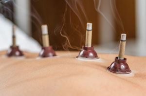 Moxibustion Kings Langley (01923)